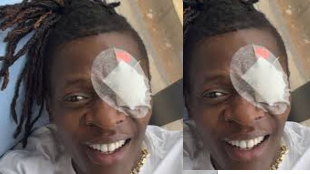Jose Chameleone Undergoes Emergency Eye Surgery